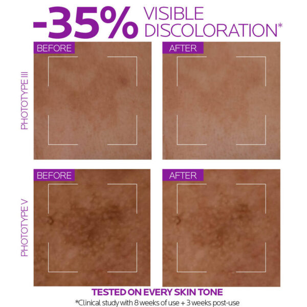 10% PURE NIACINAMIDE SERUM - Image 2